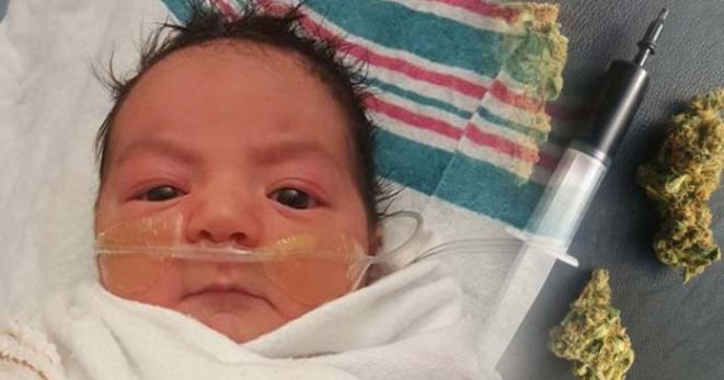 Първото бебе лекувано с конопено олио в болница